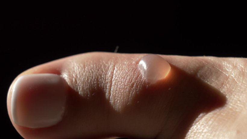 ampoules aux pieds